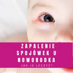 Zbliżenie na twarz noworodka z widocznymi zaczerwienionymi powiekami i łzawieniem. Tekst informuje o zapaleniu spojówek u noworodka.