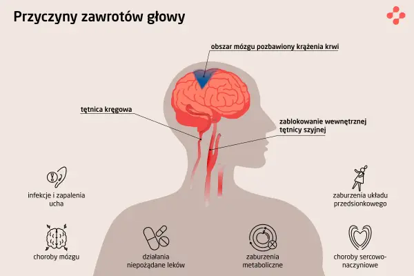 Ilustracja przedstawia przyczyny zawrotów głowy i wymiotów: blokadę tętnicy szyjnej, choroby mózgu, infekcje ucha, zaburzenia metaboliczne i sercowo-naczyniowe.