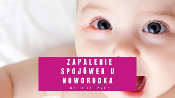 Zbliżenie na twarz noworodka z widocznymi zaczerwienionymi powiekami i łzawieniem. Tekst informuje o zapaleniu spojówek u noworodka.